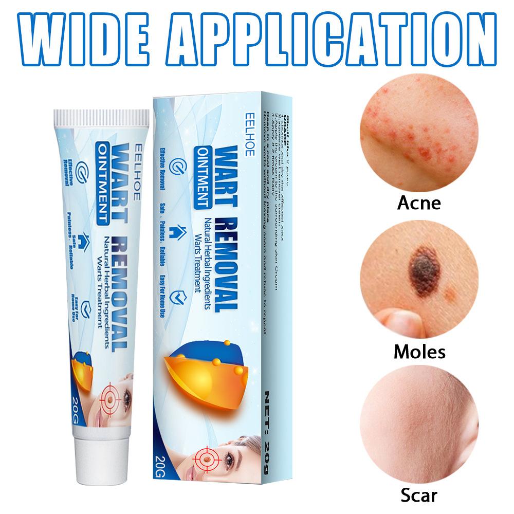 Wart Removal Cream Repairs Skin